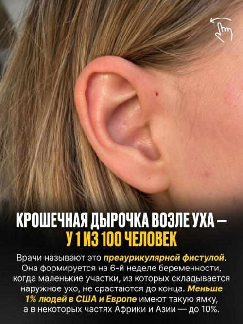 Природа раздаёт людям особенности внешности с такой разницей в шансах, что некоторые почти невозможно встретить. 02