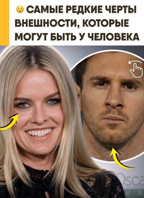 Природа раздаёт людям особенности внешности с такой разницей в шансах, что некоторые почти невозможно встретить. 
