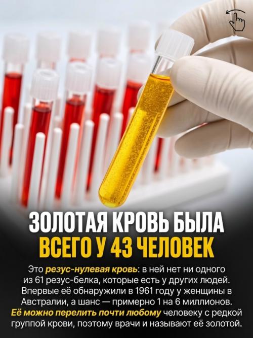 Природа раздаёт людям особенности внешности с такой разницей в шансах, что некоторые почти невозможно встретить. 06