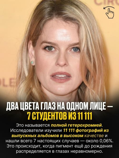 Природа раздаёт людям особенности внешности с такой разницей в шансах, что некоторые почти невозможно встретить. 05
