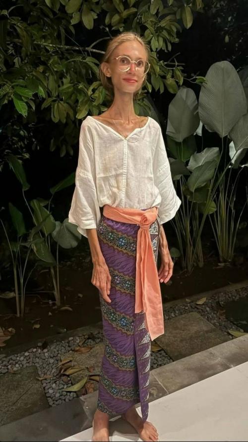 Скончалась женщина, которая ела одни фрукты: на момент смерти ее вес составлял менее 23 кг. 06