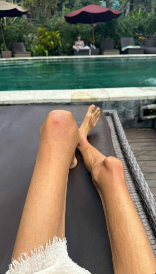 Скончалась женщина, которая ела одни фрукты: на момент смерти ее вес составлял менее 23 кг. 05