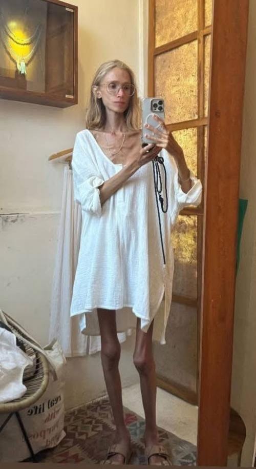 Скончалась женщина, которая ела одни фрукты: на момент смерти ее вес составлял менее 23 кг. 08