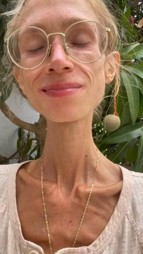 Скончалась женщина, которая ела одни фрукты: на момент смерти ее вес составлял менее 23 кг. 04