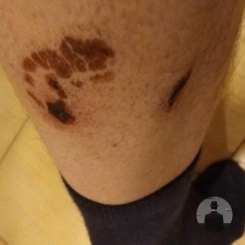 Бешенство: болезнь, которая не даёт вторых шансов. 01