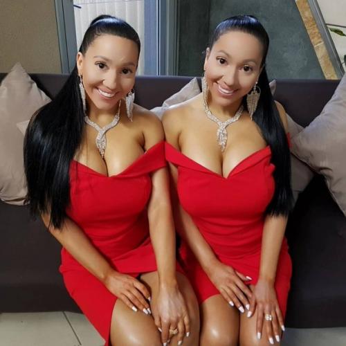 Сёстры - близняшки из Австралии потратили $250 000 на пластику. 06