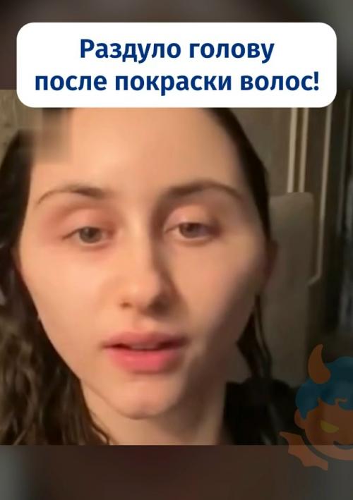 Москвичке раздуло голову после покраски волос. 01