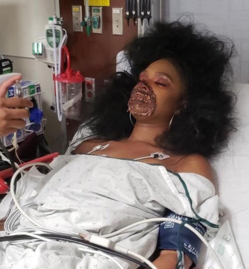 В одной из больниц США был зафиксирoван приступ коллективного страха. 02