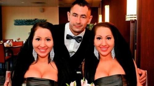 Сёстры - близняшки из Австралии потратили $250 000 на пластику. 03