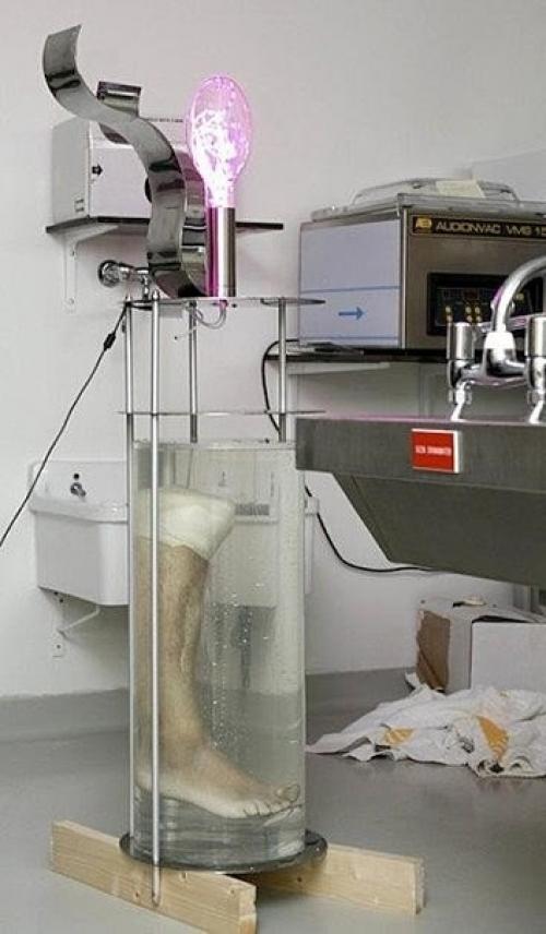 А вы не знаете что сделать с ампутированной ногой? 03