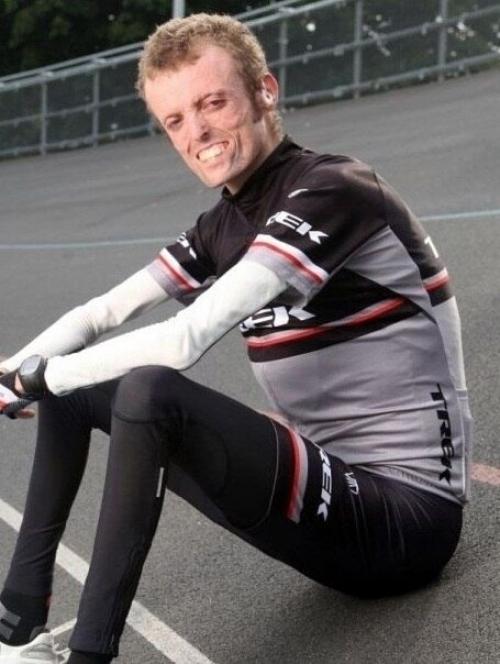 У англичанина тома станифорда настолько уникальные изменения в организме, что в мире зафиксировано еще только 8 подобных случаев.  