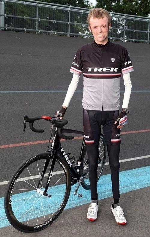 У англичанина тома станифорда настолько уникальные изменения в организме, что в мире зафиксировано еще только 8 подобных случаев. 01