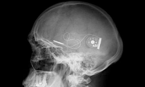 20 самых фантастических идей, ставших реальностью в 2012 году.