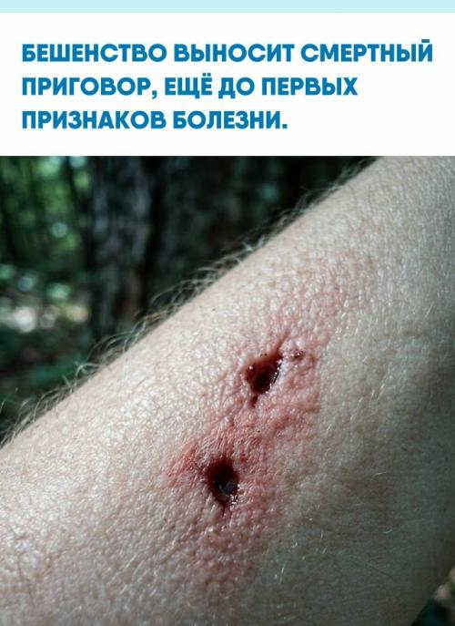 Самое страшное в бешенстве - оно может месяцами, а иногда и дольше, никак себя не выдавать.  