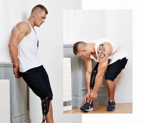 Одноногий манекенщик.  Джек эйрс из Борнмута, Великобритания, лишился правой ноги в 16-летнем возрасте из-за очагового дефекта бедренной кости.