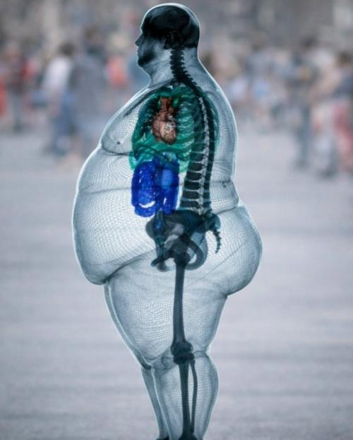 Скелет человека при ожирении практически не меняется, но сила, воздействующая на него - меняется. 

