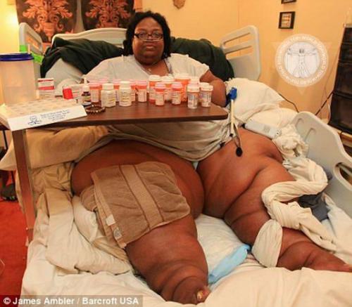 Врачи сказали самой толстой женщине в мире, американке Терри Смит (на фото), что ее ждет смерть, если она в срочном порядке не сядет на диету. 

