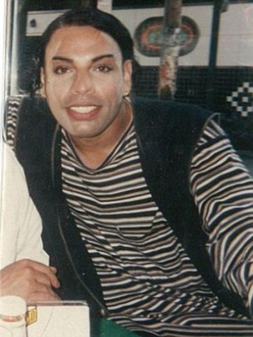 Изуродованная лжехирургом женщина - трансгендер раджи наринесинг обрела новое лицо. 01