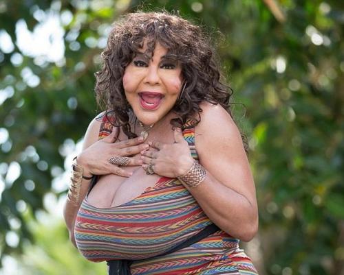 Изуродованная лжехирургом женщина - трансгендер раджи наринесинг обрела новое лицо. 06