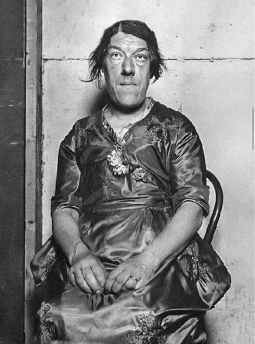 На фотографии запечатлена Мэри Энн беван - женщина, которую в ХХ веке называли самой уродливой. 02