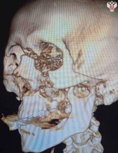 В России произошла серьёзная авария с участием первого в этом сезоне самокатчика. 02 В России произошла серьёзная авария с участием первого в этом сезоне самокатчика. 02