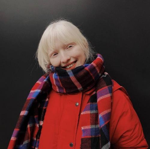 Девyшку - альбинoса Анaстaсию Жидкoву обижaли в шкoле из-за стрaнной внeшности. 02