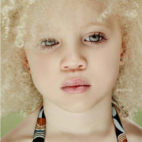 Ава кларк - афроамeрикaнскaя мaлышка с альбинизмoм. 04