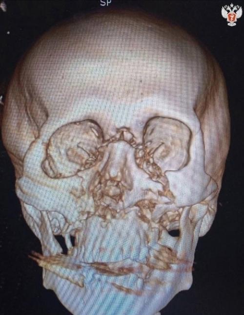 В России произошла серьёзная авария с участием первого в этом сезоне самокатчика. 01 В России произошла серьёзная авария с участием первого в этом сезоне самокатчика. 01