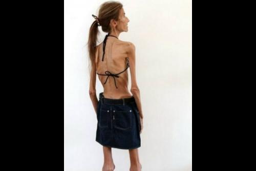 Анopeкcия - cтpaшнaя вeщь. 03