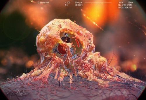 Томские ученые будут уничтожать клетки рака током.