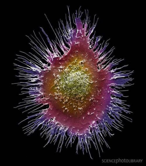 Цветная сканирующая электронная микрофотография защитной клетки иммунной системы человека, известной как дендритная клетка.