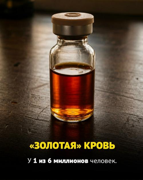 Некоторые люди от рождения обладают по-настоящему редкими генетическими особенностями, которые встречаются у единиц на всей планете. 06