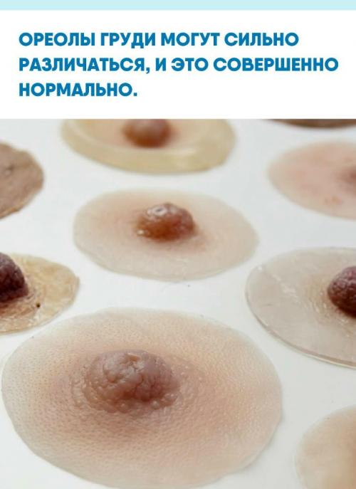 Их размер, форма и оттенок зависят от генетики, особенностей кожи, гормонального фона и возраста.  