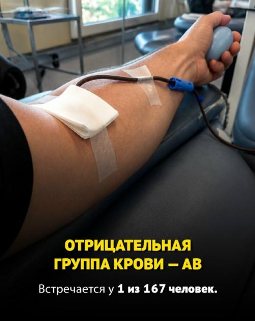 Некоторые люди от рождения обладают по-настоящему редкими генетическими особенностями, которые встречаются у единиц на всей планете. 08