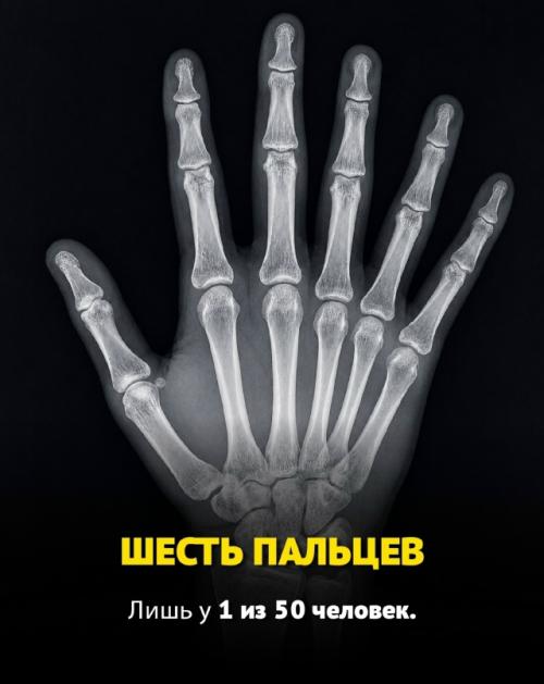 Некоторые люди от рождения обладают по-настоящему редкими генетическими особенностями, которые встречаются у единиц на всей планете. 02