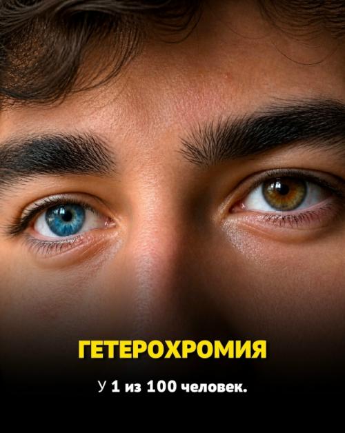 Некоторые люди от рождения обладают по-настоящему редкими генетическими особенностями, которые встречаются у единиц на всей планете. 05