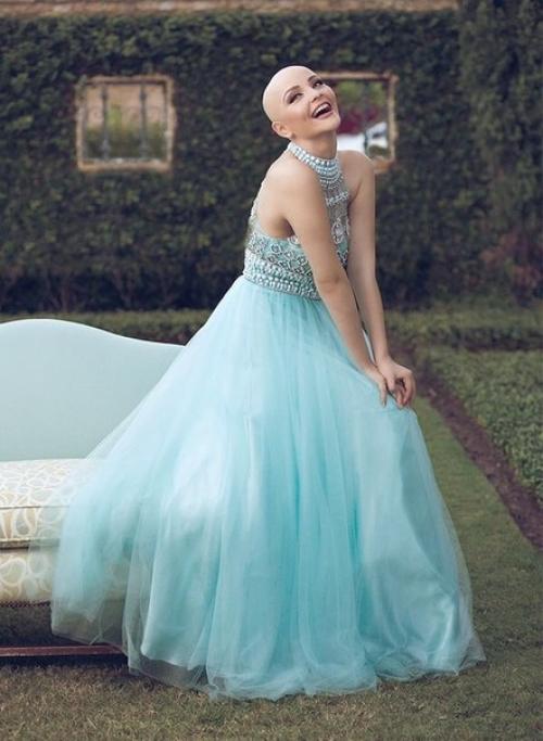 Больная раком девушка в удивительной фотосессии снялась. 02